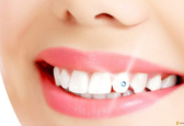 all about dental jewelry