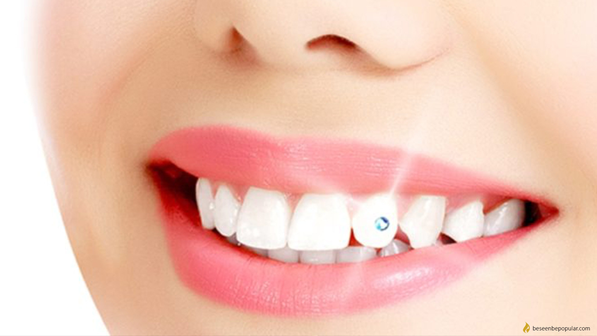 all about dental jewelry